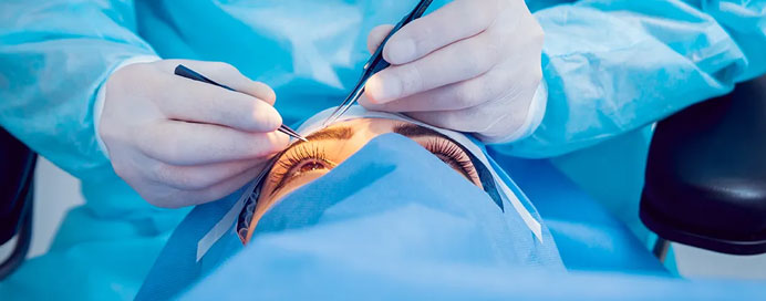 Best Bladeless Cataract Surgery In Colaba